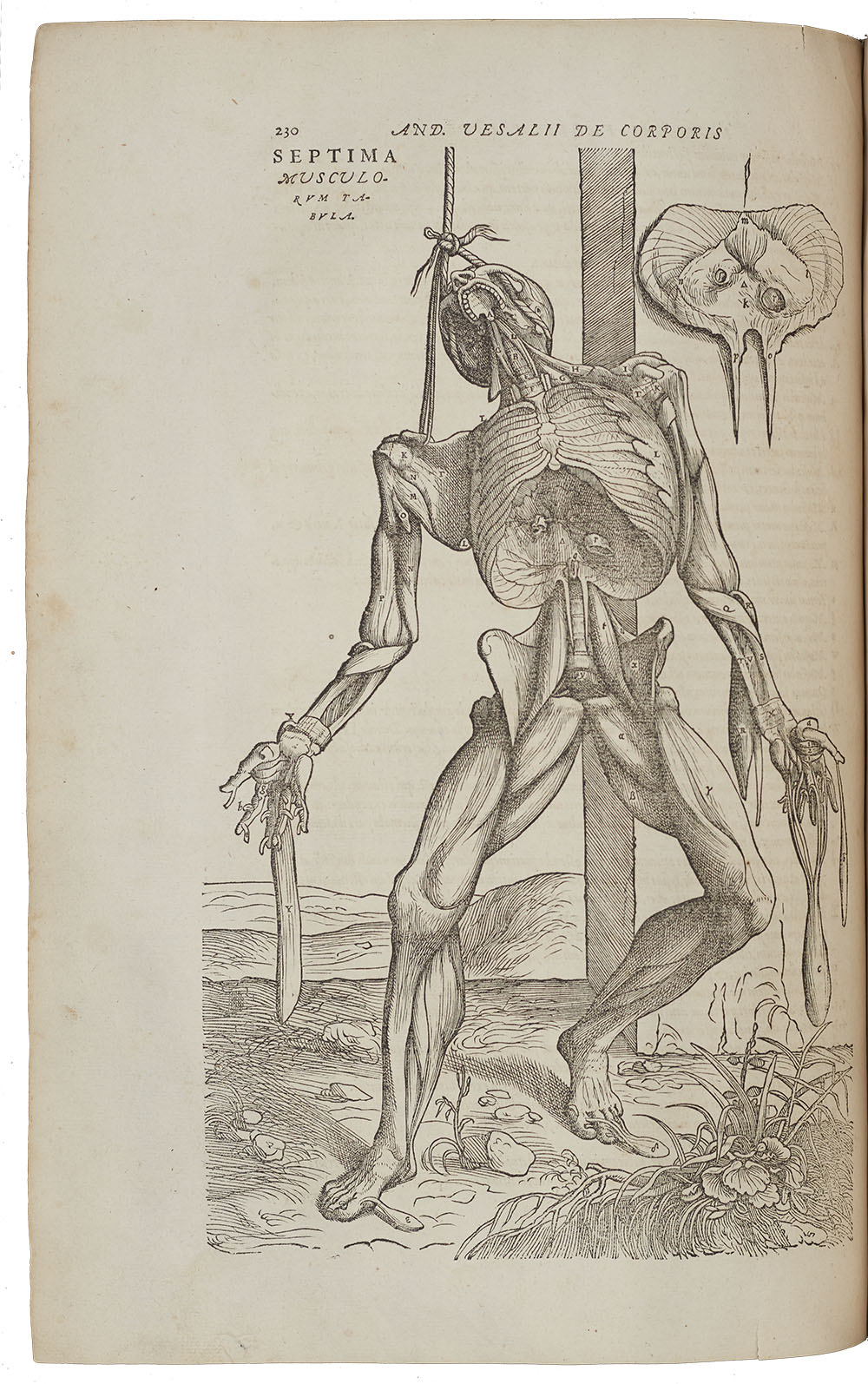 <p>Observational anatomical drawing of a human showing the removal of skin and muscles. Each part is labelled to go with accompanying text to help in the teaching of anatomy.</p>
