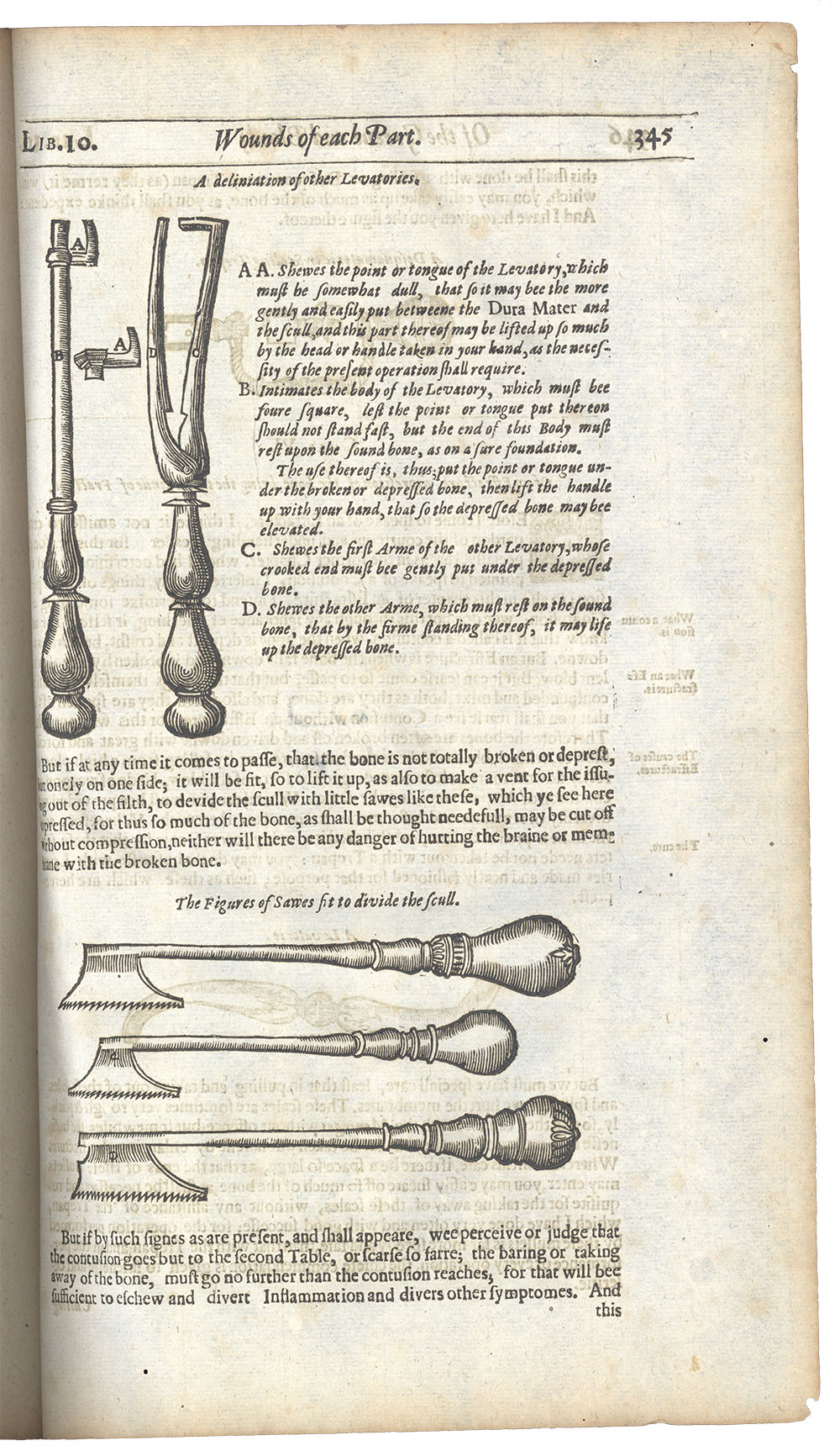<p>Page 345. Image of 17th century surgical equipment.</p>
