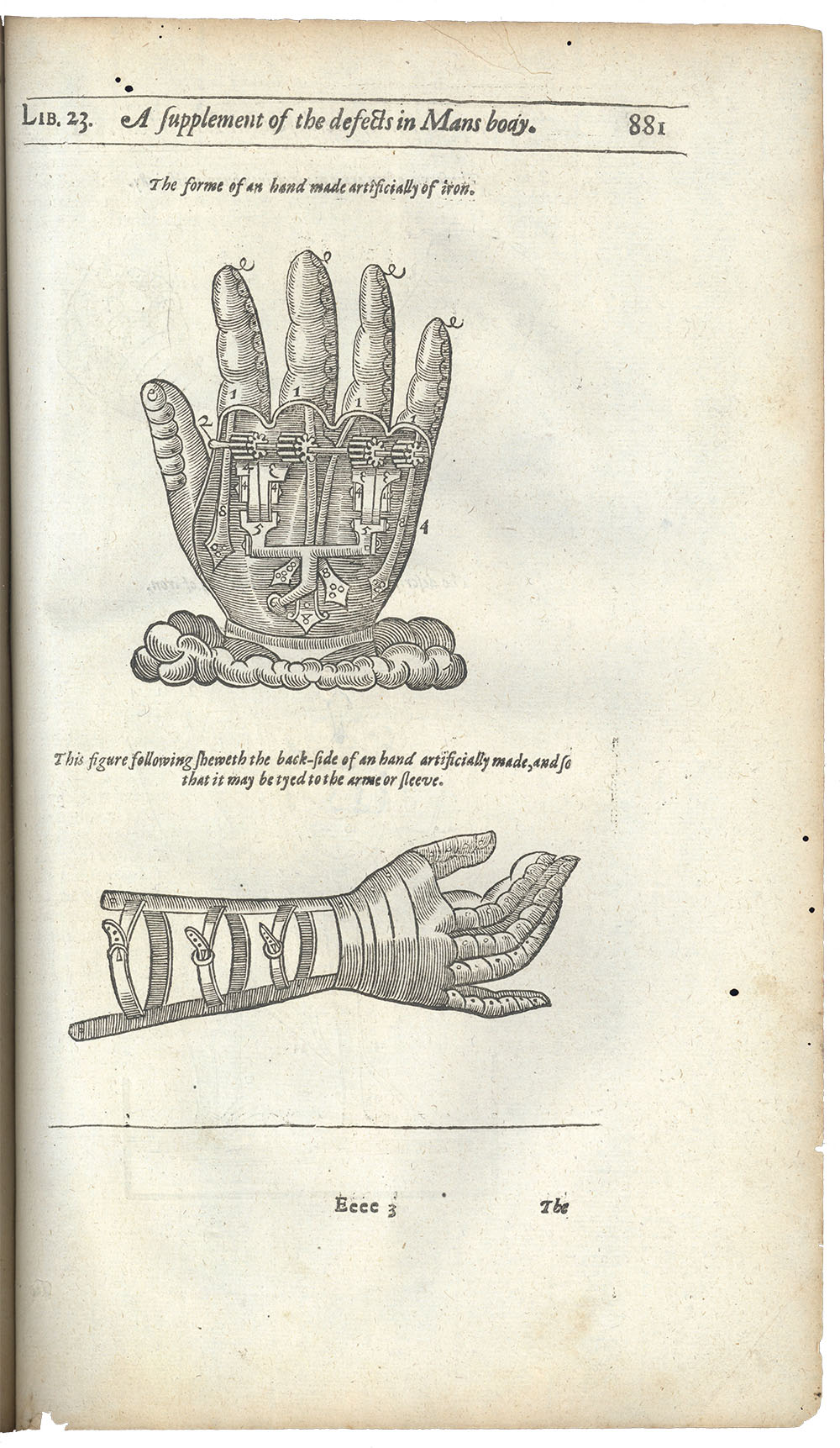 <p>Page 881. Image of 17th century prosthetic limb.</p>
